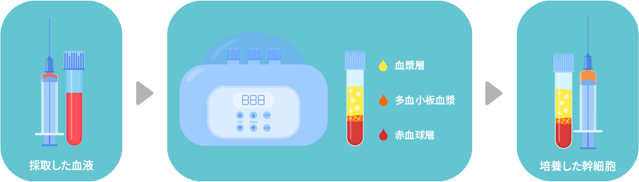 ロゴ：Platelet Rich Plasma